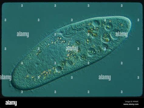  Rumpless Paramecium:  Discovering a Single-Celled Wonder That Swims With Hairy Tentacles!