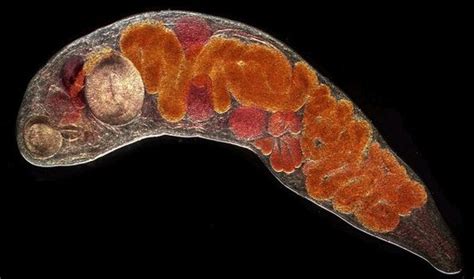  Bucephalopsis! Un Gusano Trematode Que Se Admira en el Interior de los Moluscos