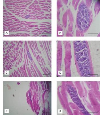  Sarcocystis: Un parásito microscópico que transforma músculos en campos de batalla para su reproducción